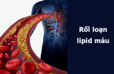Rối loạn lipid máu là gì: Nguyên nhân, triệu chứng và chuẩn đoán điều trị như thế nào?
