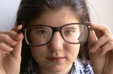 Điều trị cận thị tiến triển: Lựa chọn phương án sớm để giảm nguy cơ biến chứng