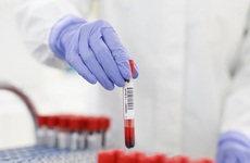 Bộ Y tế: Không sử dụng xét nghiệm kháng thể SARS-CoV-2 sai mục đích