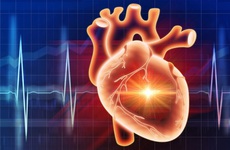 Người bị bệnh tim mạch có nên tăng cường tập thể dục hay không?