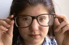 Dại mắt do đeo kính cận: Nguyên nhân và cách khắc phục hiệu quả