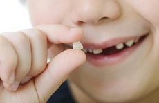Tự nhổ răng sữa tại nhà, răng bé gái 8 tuổi bị rơi vào phổi dẫn tới viêm phổi nặng