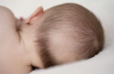 Vị trí rụng tóc ở trẻ sơ sinh và nguyên nhân nào gây rụng tóc ở trẻ?