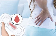 Ra máu báo thai có đau lưng không? Khi nào ra máu báo thai kèm đau lưng là nguy hiểm?