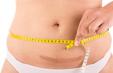 Hướng dẫn sản phụ cách giảm mỡ bụng sau sinh mổ an toàn, hiệu quả