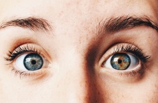 Loạn sắc tố mống mắt (Heterochromia Iridium): Thông tin từ A đến Z mà người bệnh cần biết