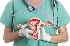 Hở eo cổ tử cung là gì? Thông tin về tình trạng hở eo cổ tử cung