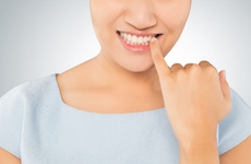 Ngứa nướu răng là gì? Những điều cần biết khi bị ngứa chân răng