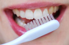 Chuyên gia gợi ý cách làm sạch mảng bám trên răng