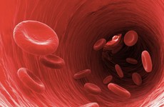 Nhiễm trùng máu có phải là ung thư máu không? Phân biệt nhiễm trùng máu và ung thư máu