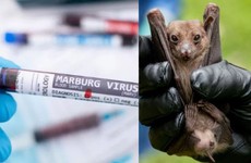 Virus Marburg: loại virus khiến WHO tuyên bố cảnh báo đợt bùng phát loại virus mới là gì?