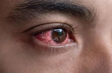 10 nguyên nhân gây đỏ mắt và cách điều trị