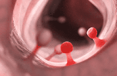 4 vị trí trong cơ thể dễ "mọc" polyp và lâu dần có thể phát triển thành ung thư mà mọi người nên cẩn trọng