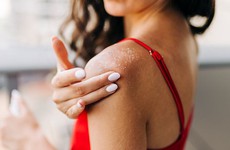 Cảnh báo dấu hiệu dị ứng kem chống nắng nghiêm trọng cần khám bác sĩ càng sớm càng tốt