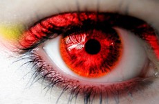 Các nguyên nhân gây bệnh đau mắt đỏ là gì?