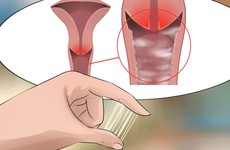 4 nguyên nhân chủ yếu gây ra bệnh viêm âm đạo - căn bệnh thường gặp ở phụ nữ