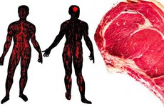 Các dấu hiệu trên cơ thể cho thấy bạn đã ăn quá nhiều thịt