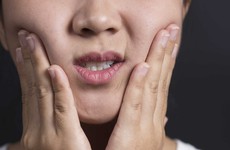 7 biểu hiện của ung thư miệng thường gặp