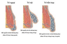 3 địa chỉ phẫu thuật cắt trĩ hiệu quả nhất tại Hà Nội