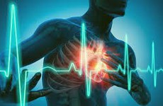 Lời khuyên của chuyên gia về cách phòng ngừa rối loạn nhịp tim