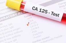 CA 125: Chỉ dấu quan trọng trong tầm soát ung thư buồng trứng