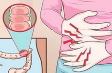 Sự nguy hiểm của đau dạ dày đi ngoài ra máu