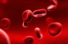 Triệu chứng bệnh máu khó đông: Coi chừng khi bị chảy máu bất thường