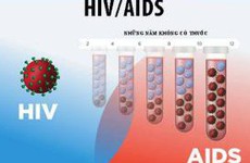 Những con đường không lây nhiễm HIV/AIDS dù tiếp xúc với người bệnh