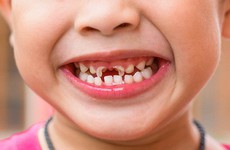 7 sai lầm nghiêm trọng về cách chăm sóc răng miệng trẻ em