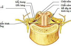 Những điều cần biết về bệnh viêm tủy cắt ngang