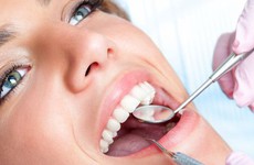 Vôi răng là gì? Ảnh hưởng của vôi răng đến sức khỏe răng miệng