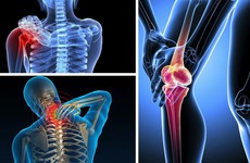 6 nguyên nhân đau nhức xương khớp bạn cần biết