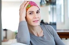 Rụng tóc khi điều trị ung thư vú, người bệnh cần làm gì?