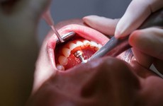 Nhận biết các dấu hiệu bệnh nướu răng