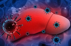 Virus viêm gan B có thể tiến triển thành bệnh xơ gan nếu không phát hiện sớm