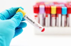 Các xét nghiệm trong chẩn đoán viêm gan B