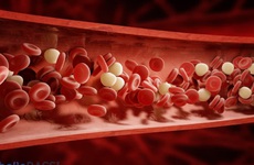 Xơ gan gây giảm tiểu cầu: Mối nguy hiểm khôn lường cho sức khỏe