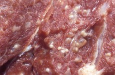 Thịt lợn nhiễm sán nguy hiểm đến mức nào?