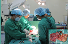 Phẫu thuật cắt dạ dày trong điều trị ung thư được tiến hành như thế nào?