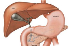 Nhầm tưởng là đau dạ dày thông thường bệnh nhân ung thư gan tá hoả khi bị chẩn đoán giai đoạn cuối