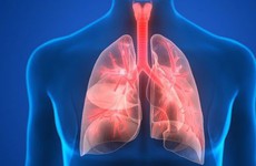 Tổng hợp các phương pháp điều trị viêm phổi bạn cần biết