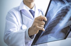Viêm phổi bệnh viện: dấu hiệu, đánh giá, cách điều trị và phòng ngừa