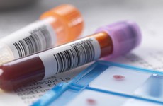 Các kiểm tra và xét nghiệm giúp chẩn đoán bệnh viêm phổi