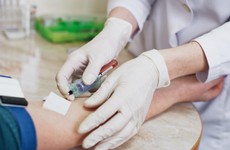 Tìm hiểu về các phương pháp xét nghiệm sốt xuất huyết: gồm những gì và khi nào cần?