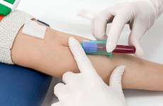 Xét nghiệm máu có giúp chẩn đoán sốt xuất huyết không?