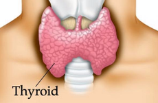 Những thói quen sau đây có thể là nguyên nhân gây ung thư tuyến giáp