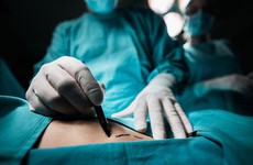 Những ai nên thực hiện phẫu thuật cắt bỏ tuyến giáp?