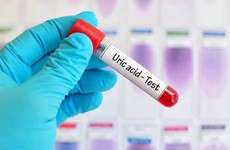 Acid uric: Mối liên quan giữa acid uric và bệnh gout, khi nào cần xét nghiệm chỉ số này?