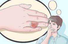 Các tiêu chí chẩn đoán gout: Có phải cứ tăng acid uric máu là bị bệnh gout?