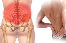 Yếu tố nguy cơ nào khiến bạn dễ bị đau lưng hơn?
